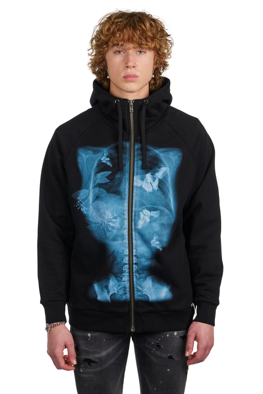X-Ray Zip Up Hoodie