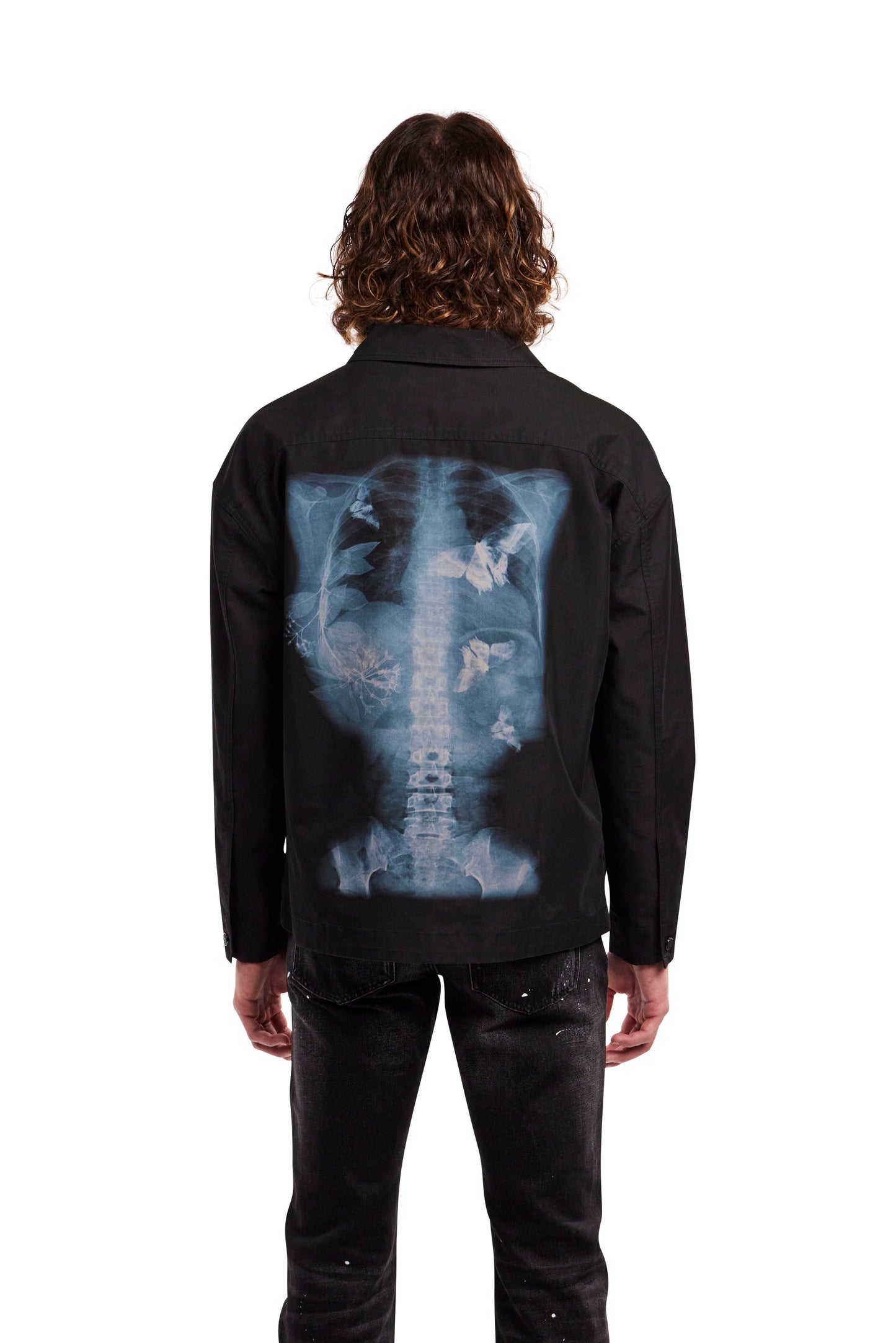 X-Ray Shirt Jacket