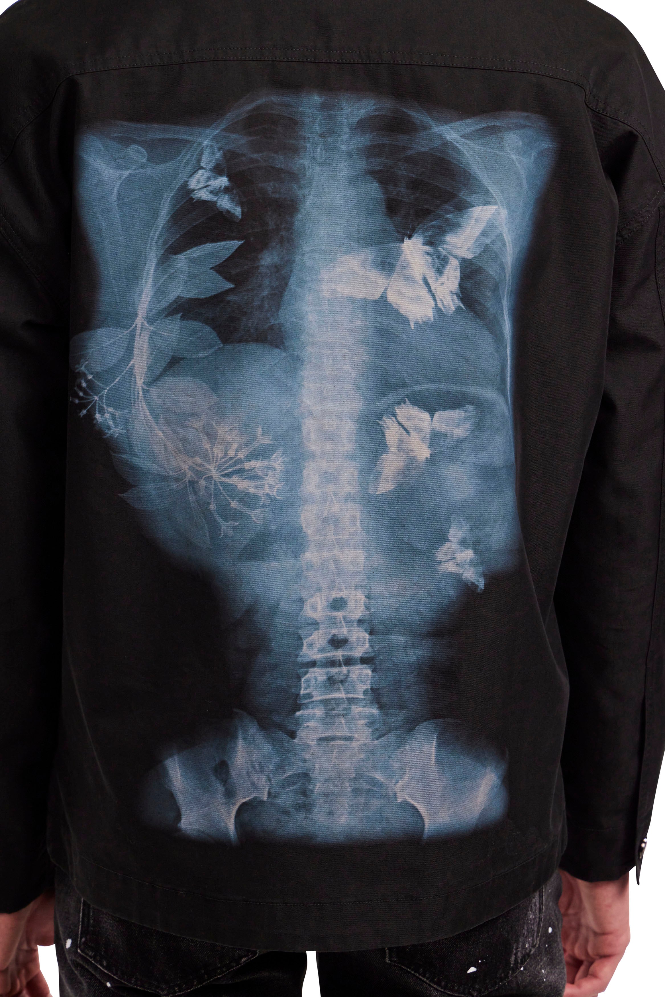 X-Ray Shirt Jacket – Dead. Than. Cool.
