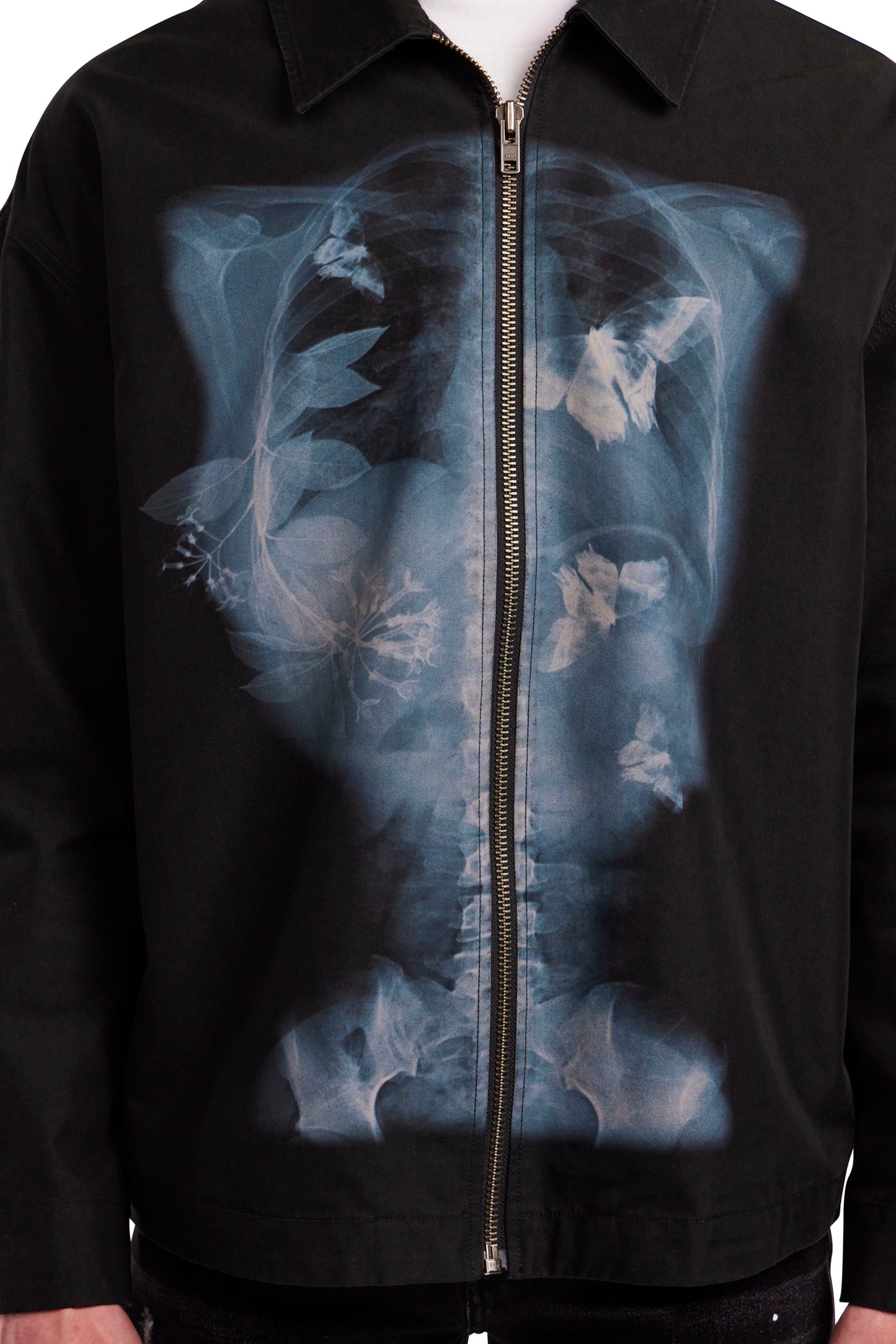 X-Ray Shirt Jacket